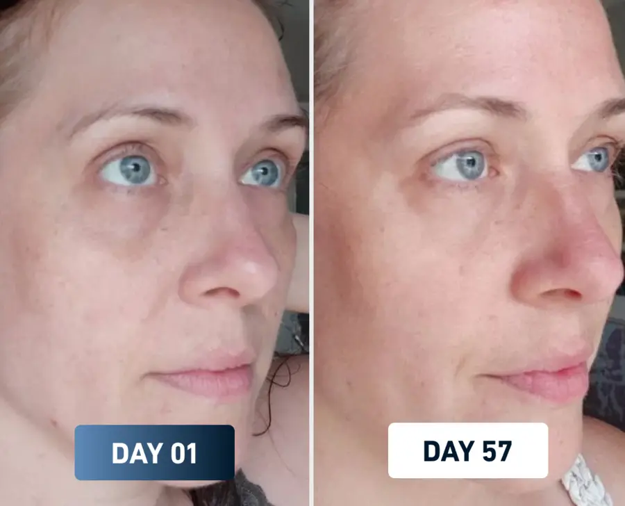Skin before and after
