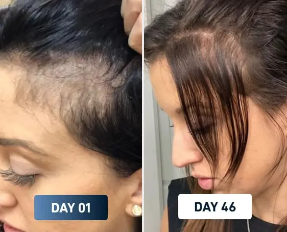 Hair before and after
